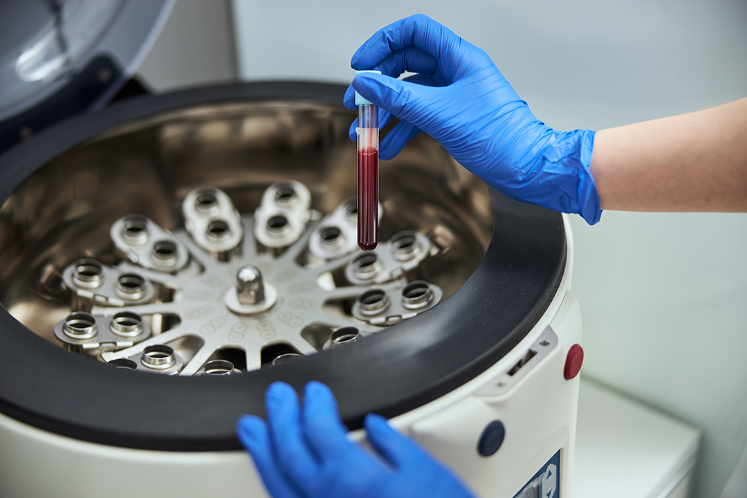 prp for knee pain