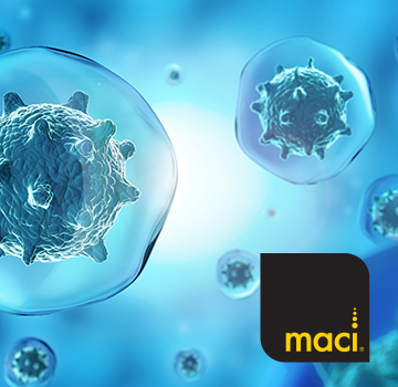 Regenerative Cartilage Therapy (MACI Procedure) performed by Dr. Robert Burke, orthopedic surgeon in Houston, Texas.
