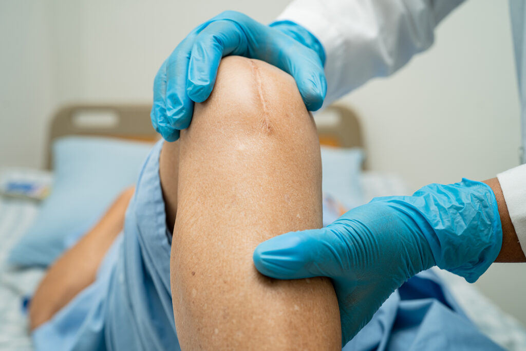 How Bad Does Knee Pain Need to Be for Surgery?